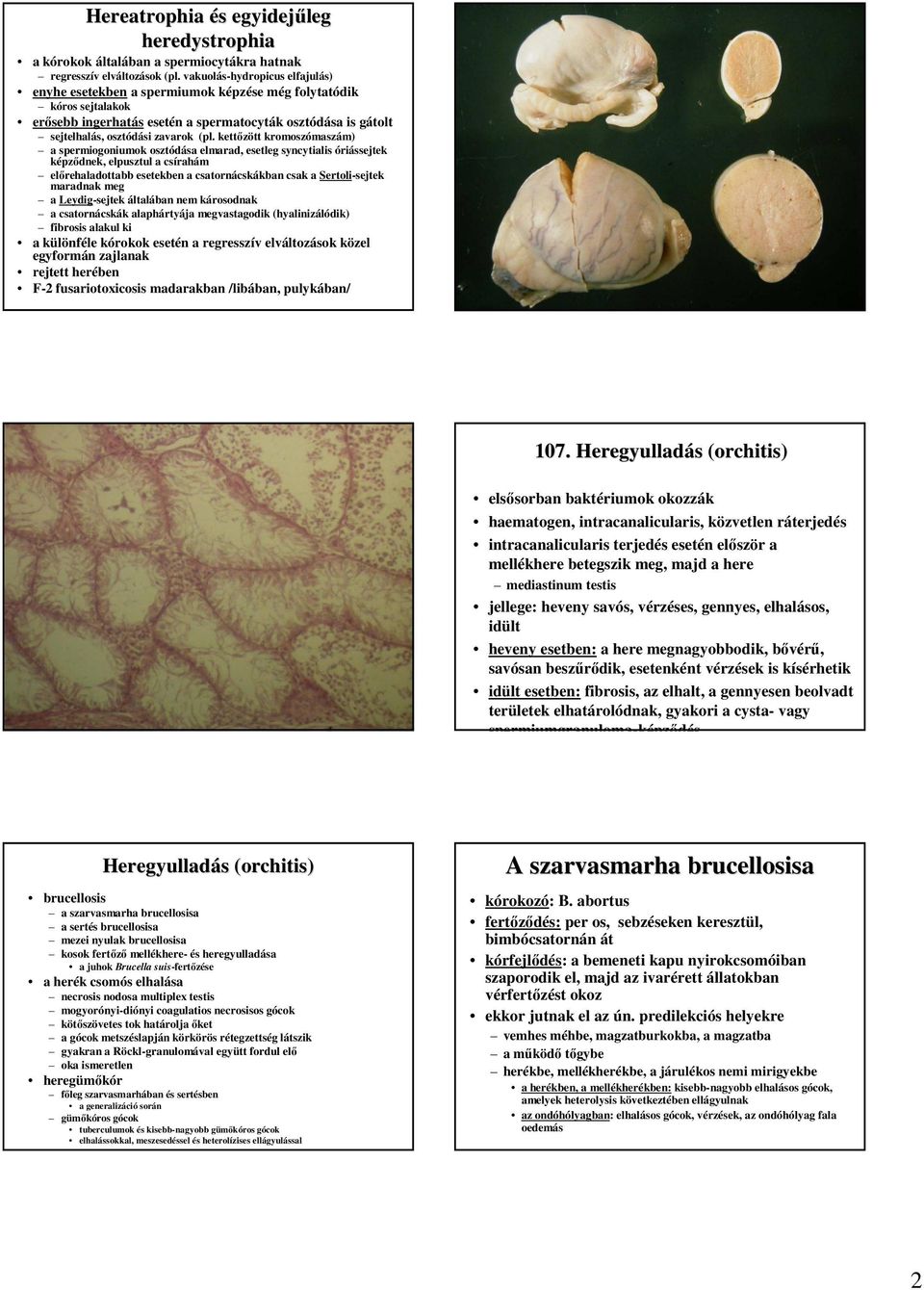 kettızött kromoszómaszám) a spermiogoniumok osztódása elmarad, esetleg syncytialis óriássejtek képzıdnek, elpusztul a csírahám elırehaladottabb esetekben a csatornácskákban csak a Sertoli-sejtek