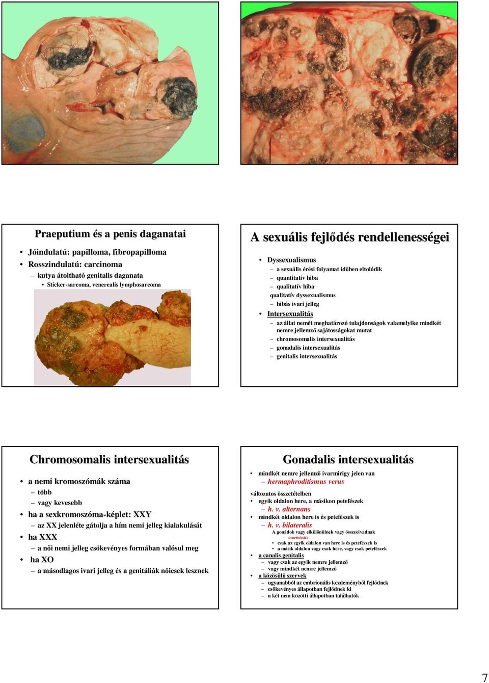 tulajdonságok valamelyike mindkét nemre jellemzı sajátosságokat mutat chromosomalis intersexualitás gonadalis intersexualitás genitalis intersexualitás Chromosomalis intersexualitás a nemi