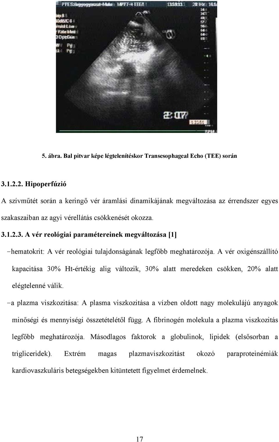 1.2.3. A vér reológiai paramétereinek megváltozása [1] -hematokrit: A vér reológiai tulajdonságának legfőbb meghatározója.