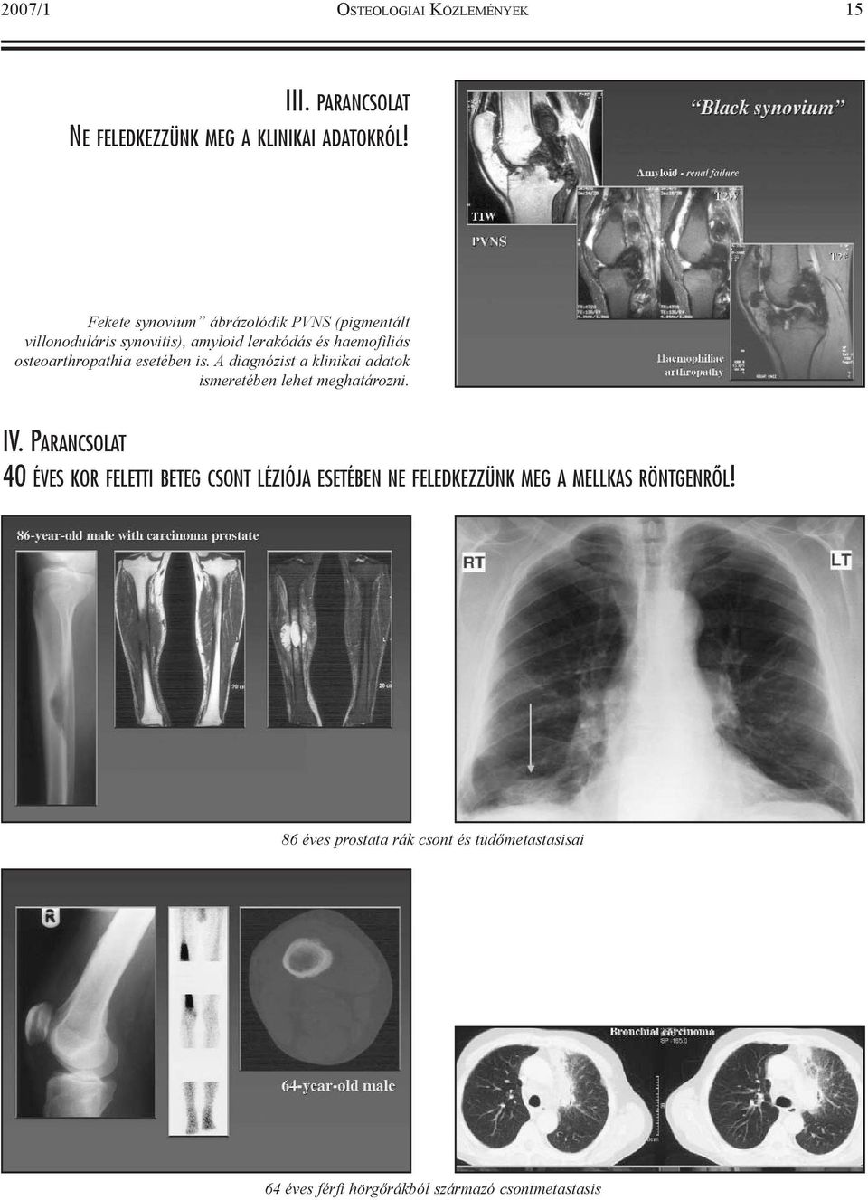 esetében is. A diagnózist a klinikai adatok ismeretében lehet meghatározni. IV.