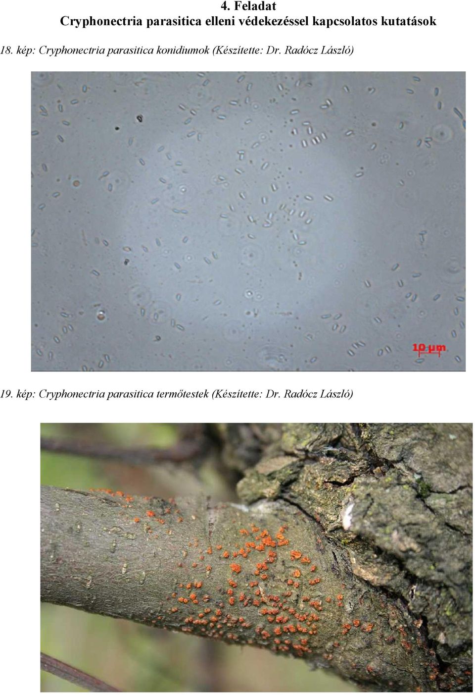 kép: Cryphonectria parasitica konidiumok (Készítette: Dr.