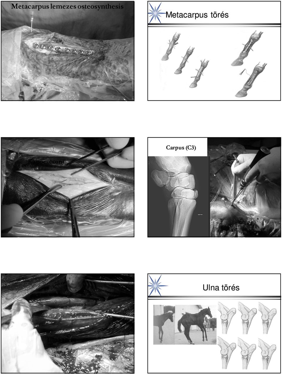 Metacarpus törés Carpus