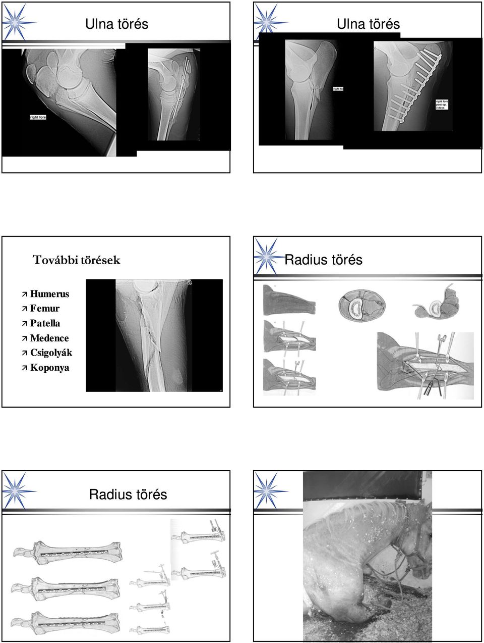 törés Humerus Femur Patella