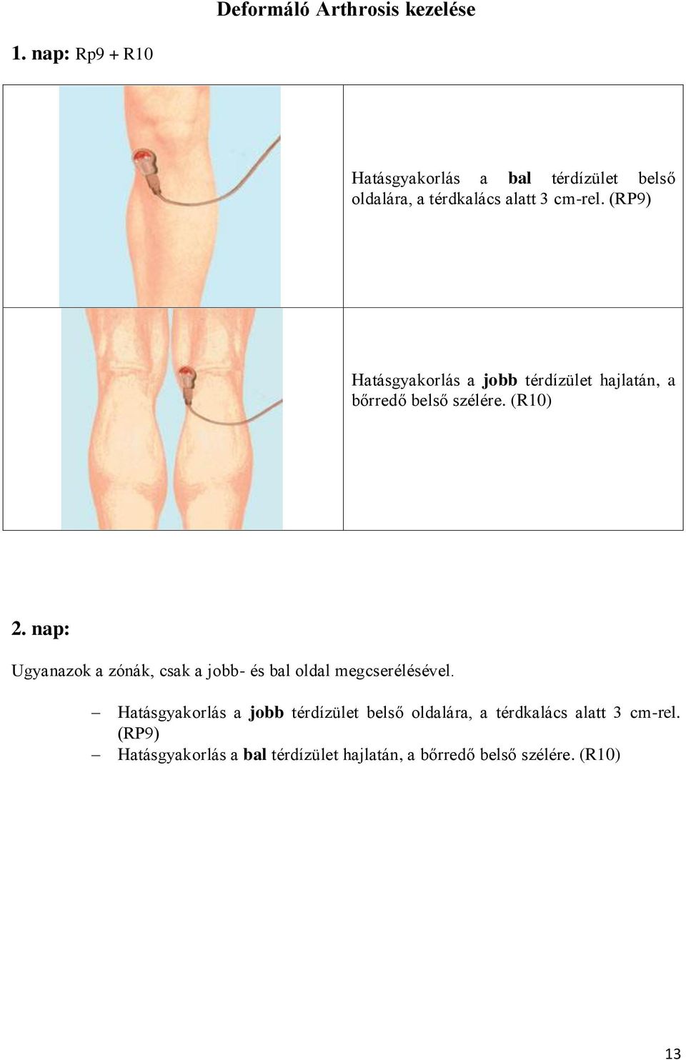 arthrosis 2 evőkanál térdízület kezelése)