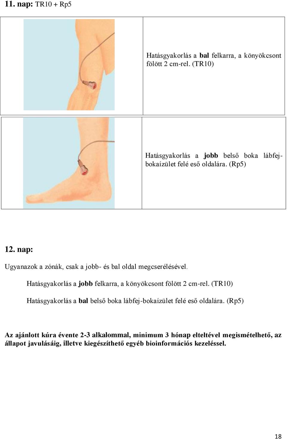 arthrosis artritisz kezelési könyv hogyan kezeljük a csuklószalag repedését