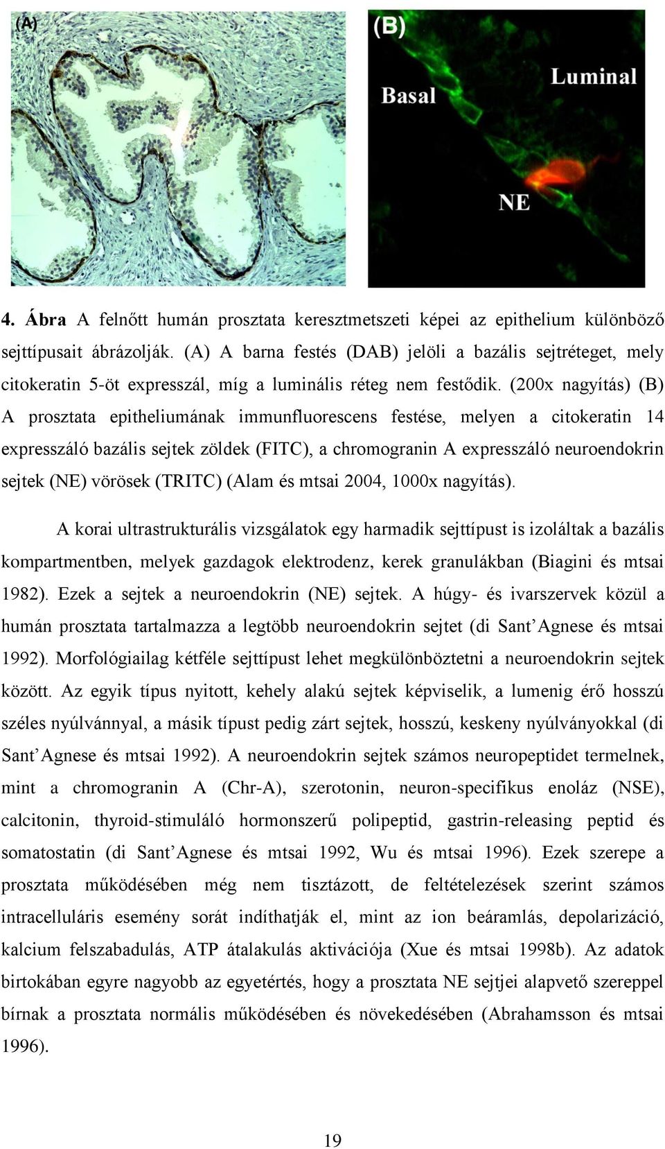 (200x nagyítás) (B) A prosztata epitheliumának immunfluorescens festése, melyen a citokeratin 14 expresszáló bazális sejtek zöldek (FITC), a chromogranin A expresszáló neuroendokrin sejtek (NE)