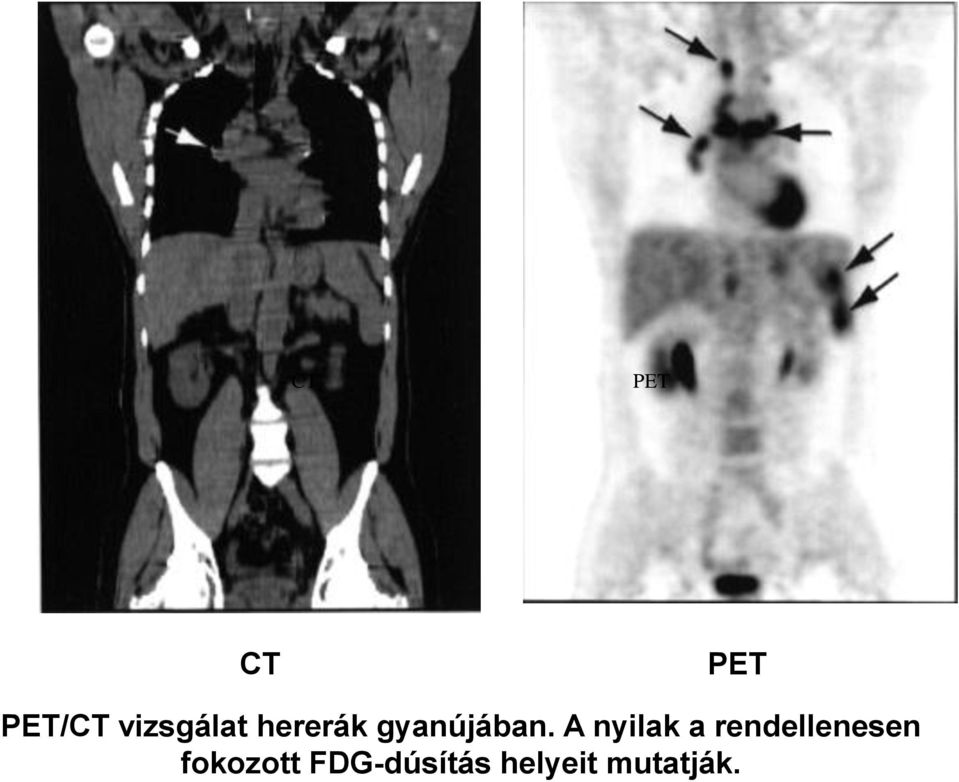 A nyilak a rendellenesen