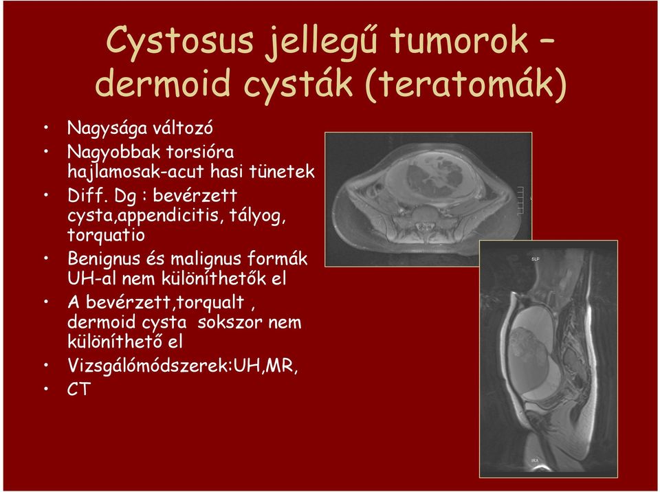 Dg : bevérzett cysta,appendicitis, tályog, torquatio Benignus és malignus