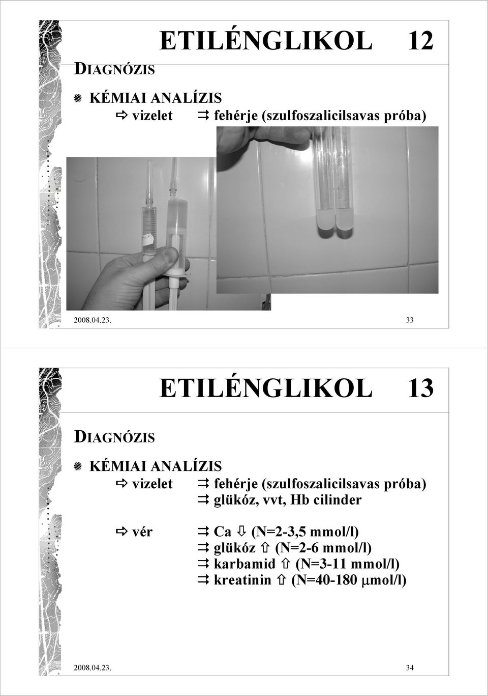 33 ETILÉNGLIKOL 13 DIAGNÓZIS KÉMIAI ANALÍZIS vizelet fehérje (szulfoszalicilsavas