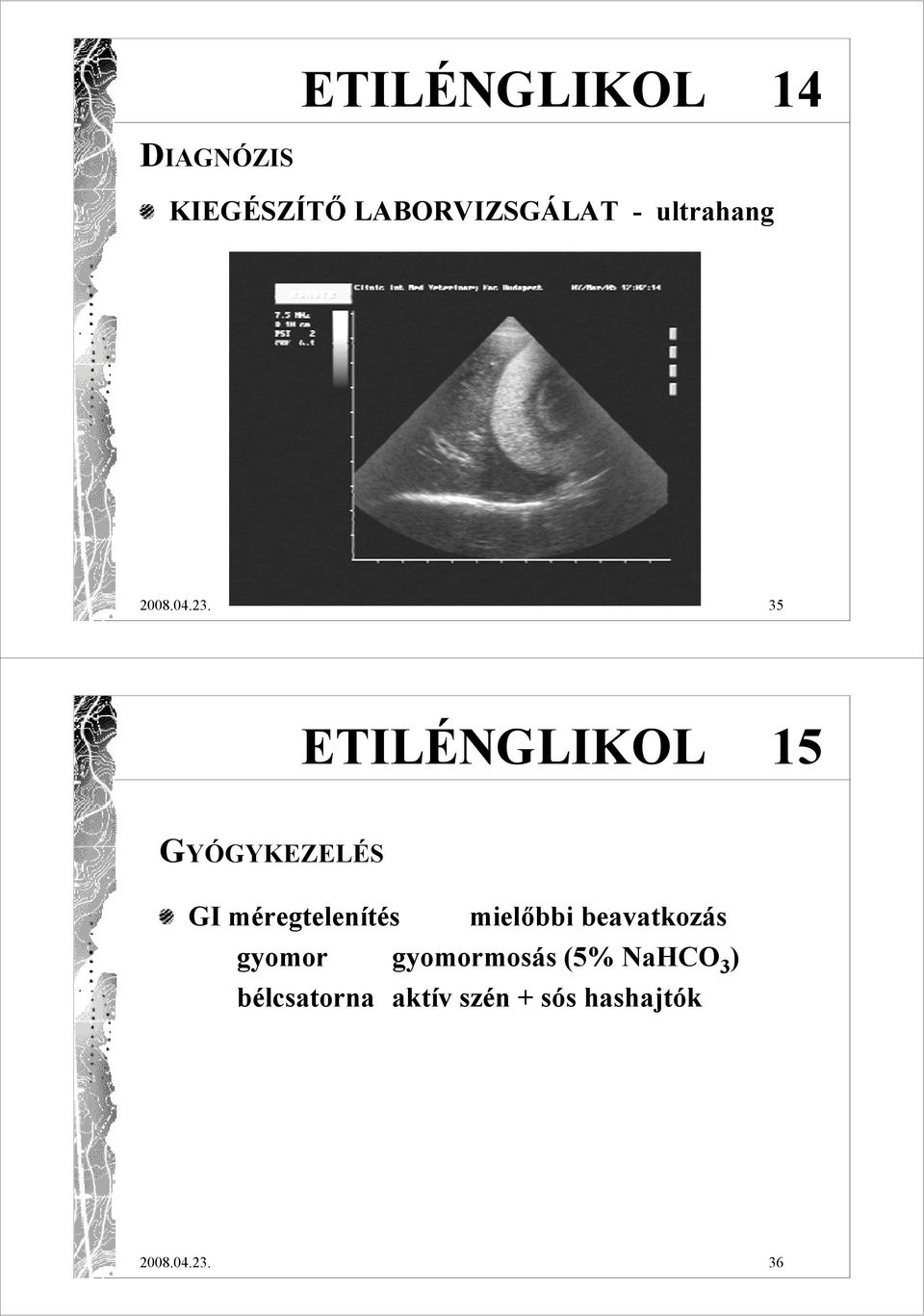 35 ETILÉNGLIKOL 15 GYÓGYKEZELÉS GI méregtelenítés mielıbbi