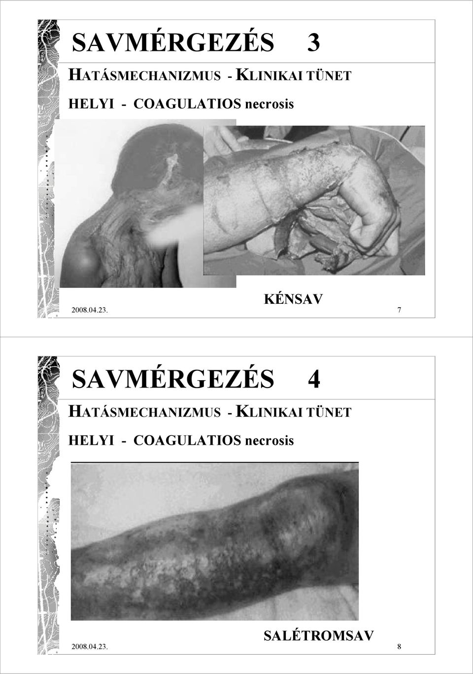 7 SAVMÉRGEZÉS 4 HATÁSMECHANIZMUS - KLINIKAI TÜNET