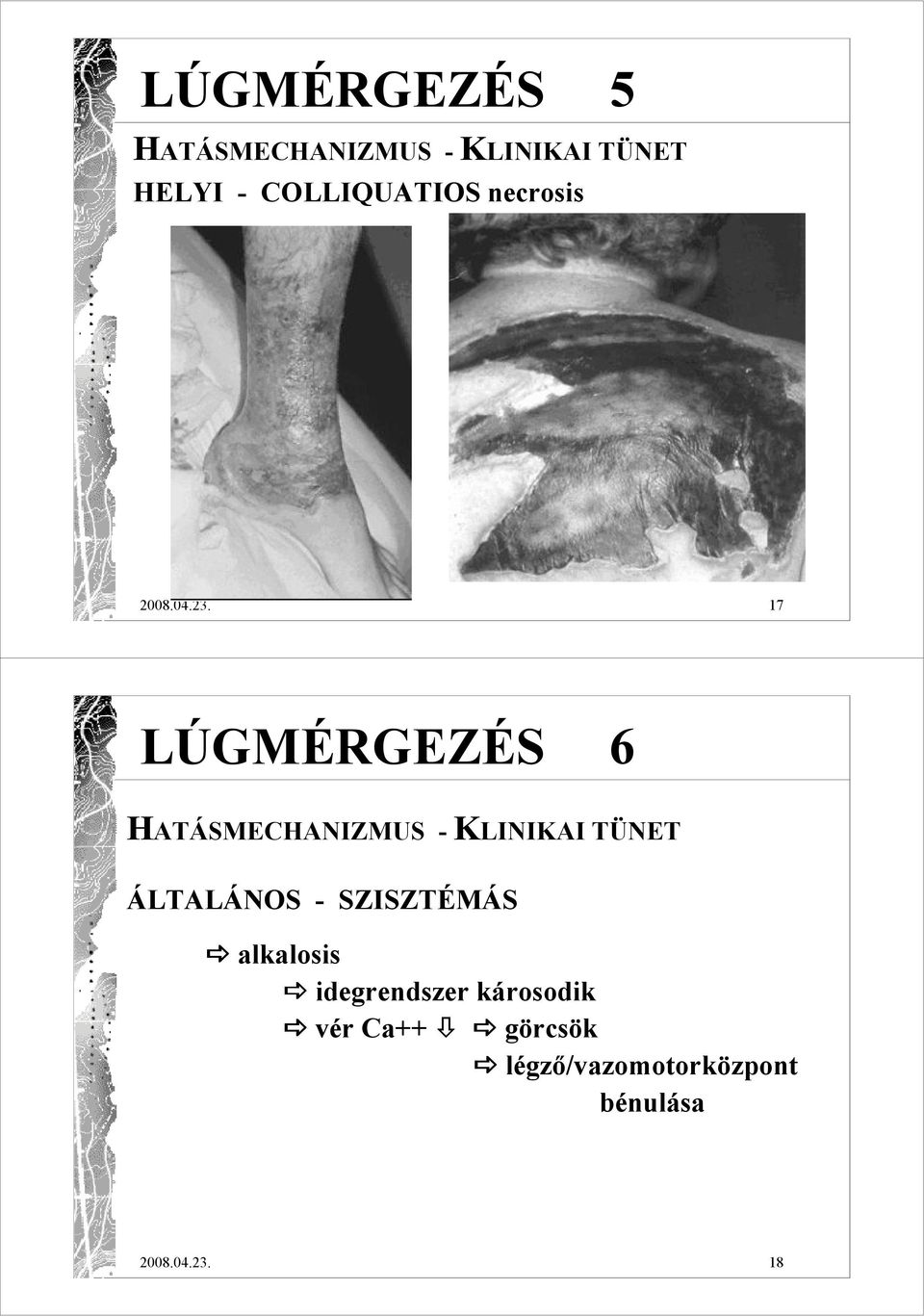 17 LÚGMÉRGEZÉS 6 HATÁSMECHANIZMUS - KLINIKAI TÜNET ÁLTALÁNOS -