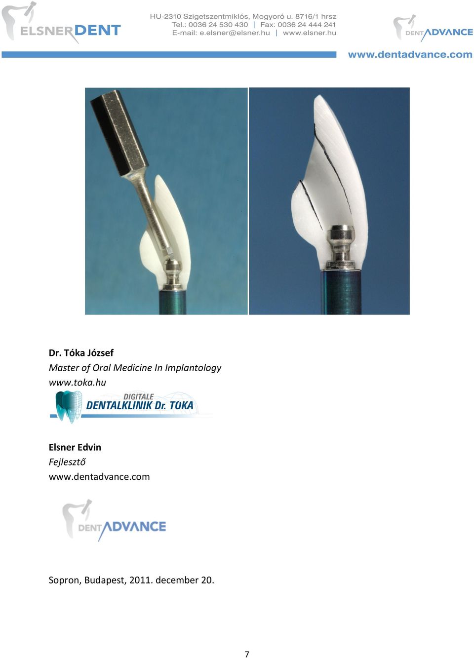 Implantátumokra közvetlenül felcsavarozott híd készítésének elméleti  tudnivalói és gyakorlati tanácsok - PDF Free Download