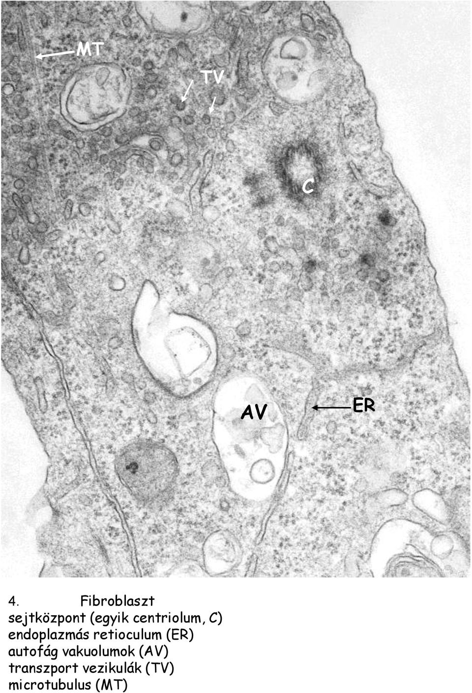 centriolum, C) endoplazmás retioculum