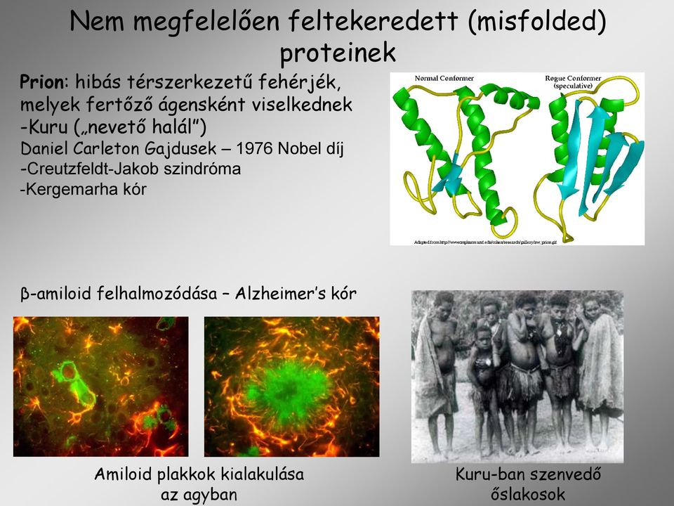 Carleton Gajdusek 1976 Nobel díj -Creutzfeldt-Jakob szindróma -Kergemarha kór