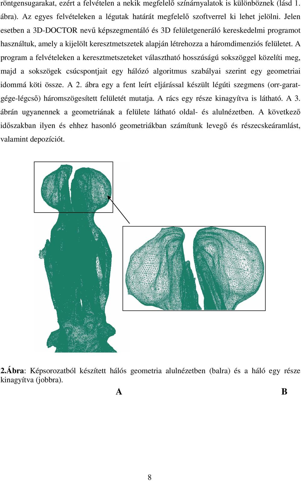 A program a felvételeken a keresztmetszeteket választható hosszúságú sokszöggel közelíti meg, majd a sokszögek csúcspontjait egy hálózó algoritmus szabályai szerint egy geometriai idommá köti össze.