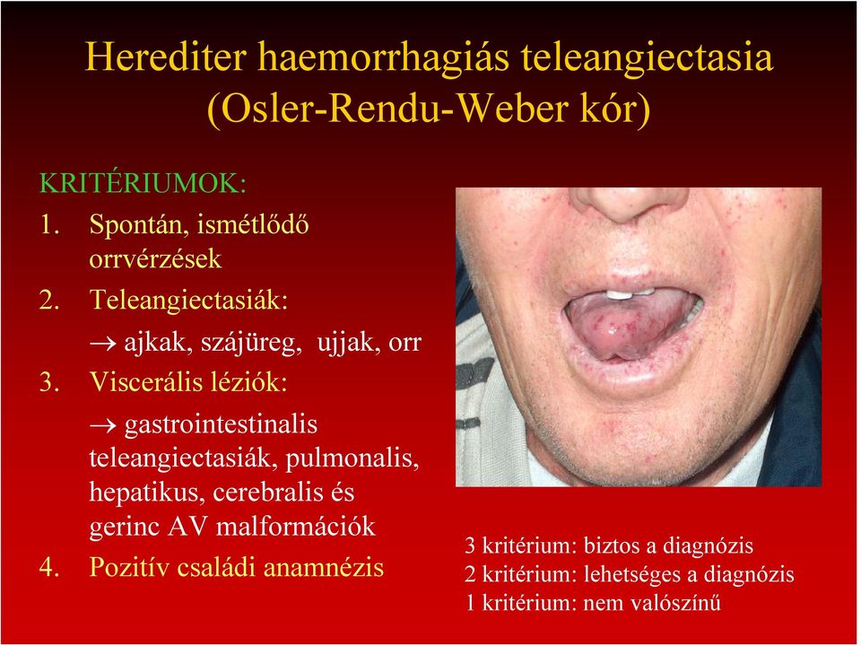 Viscerális léziók: gastrointestinalis teleangiectasiák, pulmonalis, hepatikus, cerebralis és gerinc