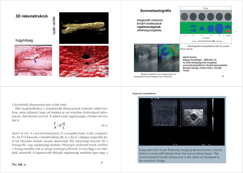 Radiológia - 8;8(-) Az emlő betegségeinek vizsgálata szonoelasztográiával.