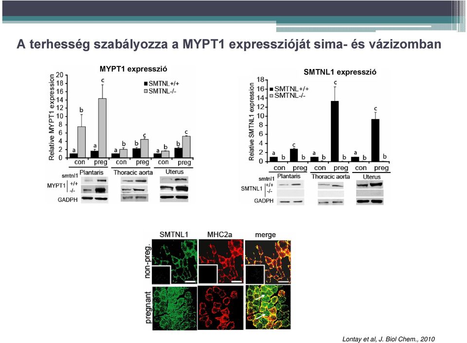 MYPT1 expresszió SMTNL1