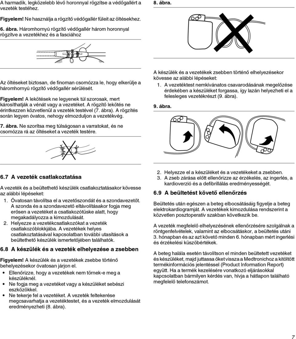 Háromhornyú rögzítő védőgallér három horonnyal rögzítve a vezetékhez és a fasciához Az öltéseket biztosan, de finoman csomózza le, hogy elkerülje a háromhornyú rögzítő védőgallér sérülését. Figyelem!