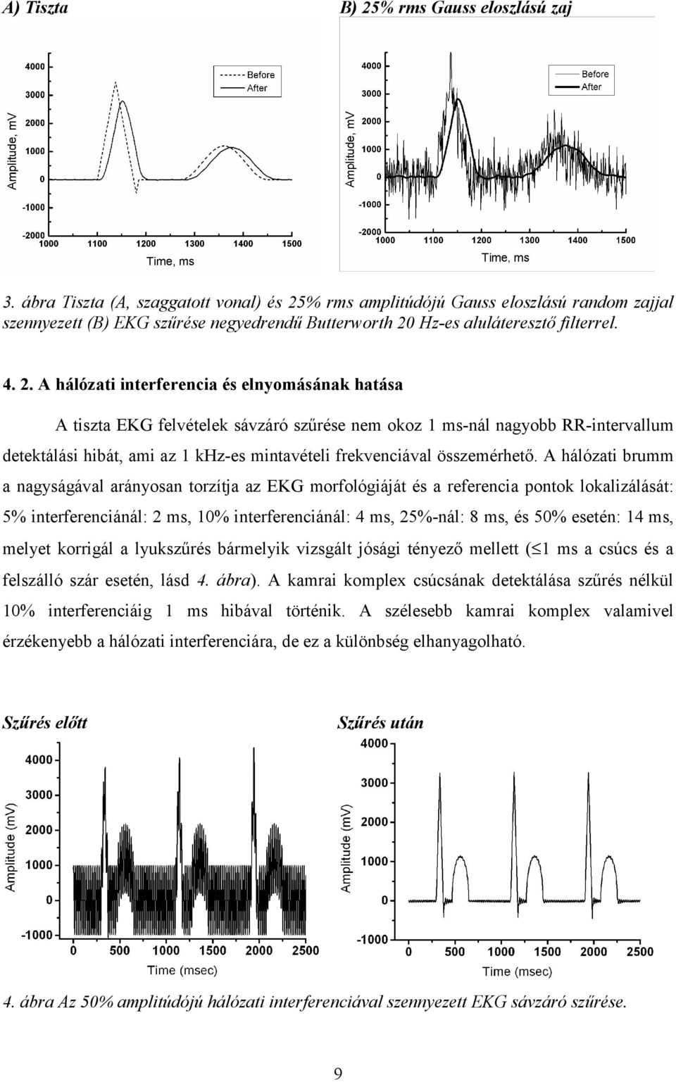 % rms amplitúdójú Gauss eloszlású random zajjal szennyezett (B) EKG szűrése negyedrendű Butterworth 20