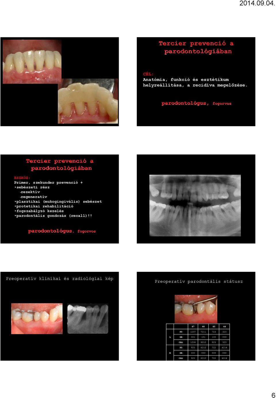 (mukogingivális) sebészet protetikai rehabilitáció fogszabályzó kezelés parodontális gondozás (recall)!
