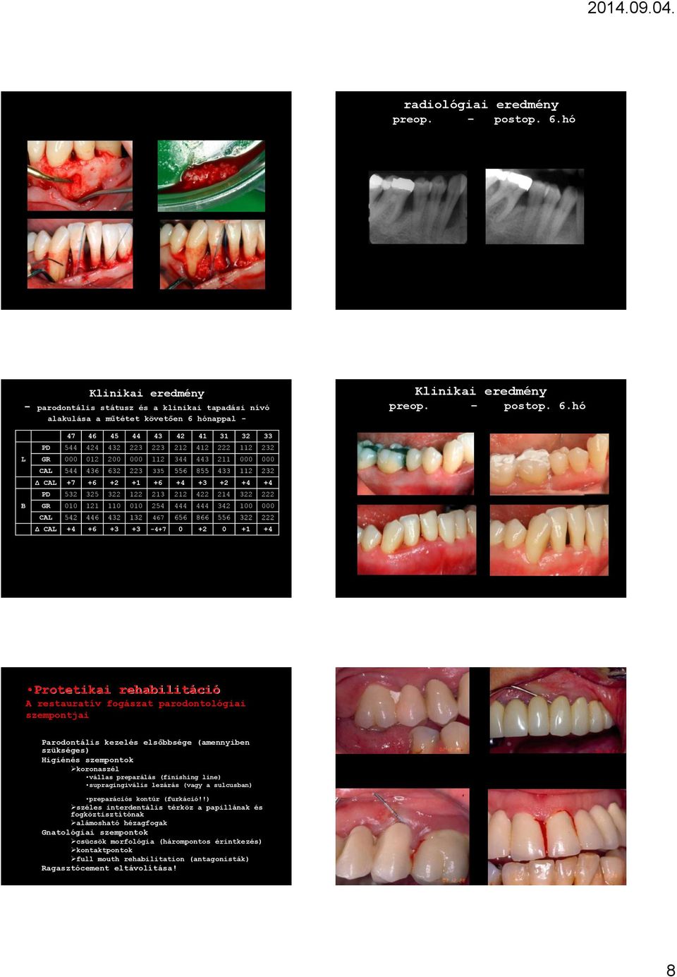 hónappal - Klinikai eredmény preop. postop. 6.