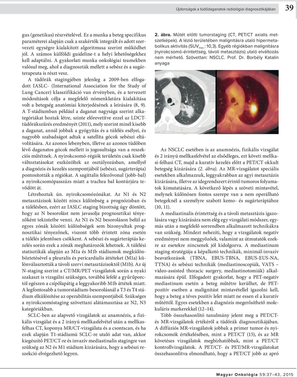 A számos külföldi guideline-t a helyi lehetőségekhez kell adaptálni. A gyakorlati munka onkológiai teamekben valósul meg, ahol a diagnoszták mellett a sebész és a sugárterapeuta is részt vesz.