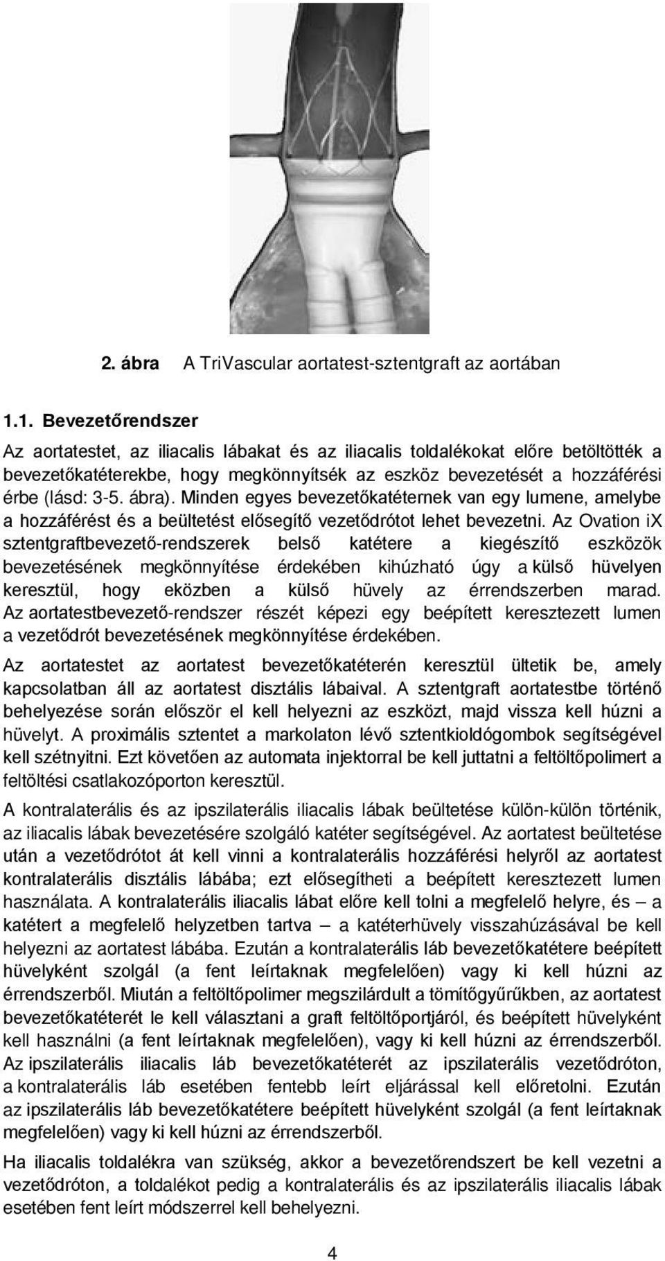 ábra). Minden egyes bevezetőkatéternek van egy lumene, amelybe a hozzáférést és a beültetést elősegítő vezetődrótot lehet bevezetni.