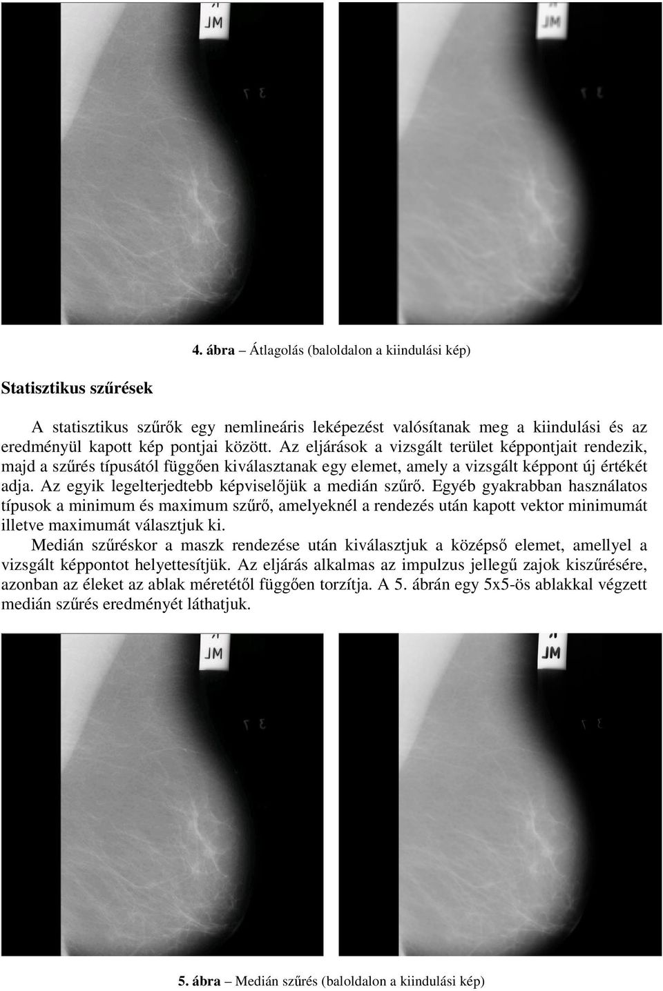 Az egyik legelterjedtebb képviseljük a medián szr. Egyéb gyakrabban használatos típusok a minimum és maximum szr, amelyeknél a rendezés után kapott vektor minimumát illetve maximumát választjuk ki.