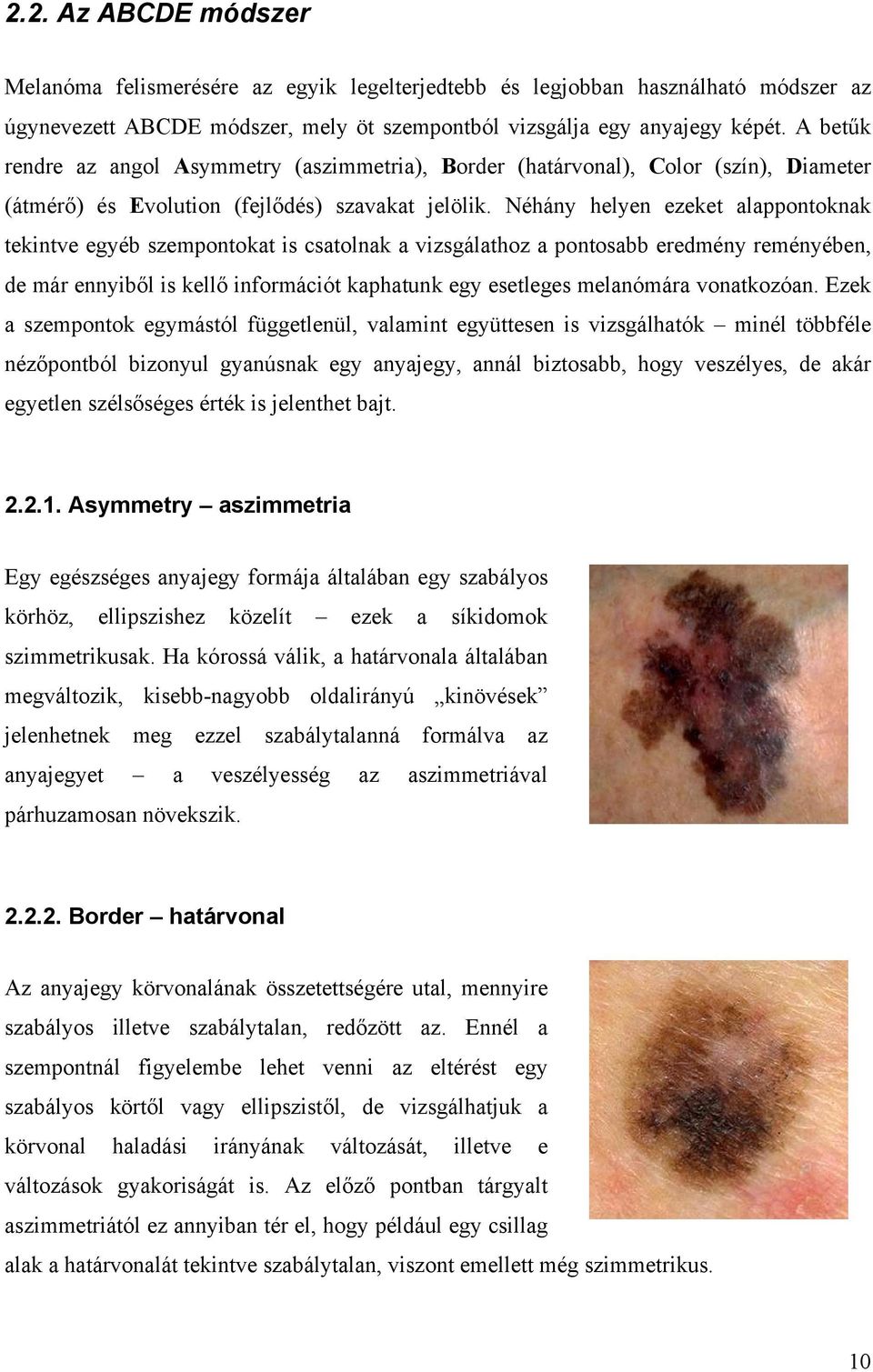 Néhány helyen ezeket alappontoknak tekintve egyéb szempontokat is csatolnak a vizsgálathoz a pontosabb eredmény reményében, de már ennyiből is kellő információt kaphatunk egy esetleges melanómára