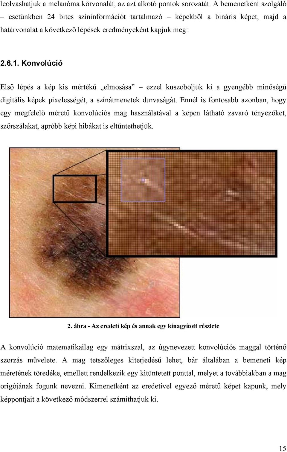 Konvolúció Első lépés a kép kis mértékű elmosása ezzel küszöböljük ki a gyengébb minőségű digitális képek pixelességét, a színátmenetek durvaságát.
