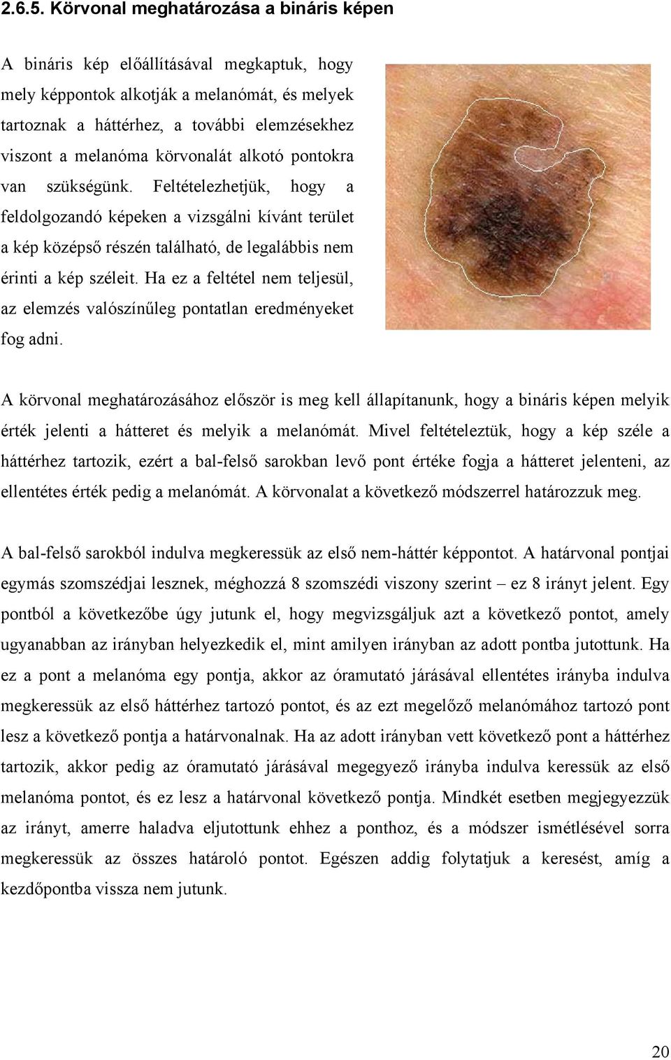 körvonalát alkotó pontokra van szükségünk. Feltételezhetjük, hogy a feldolgozandó képeken a vizsgálni kívánt terület a kép középső részén található, de legalábbis nem érinti a kép széleit.