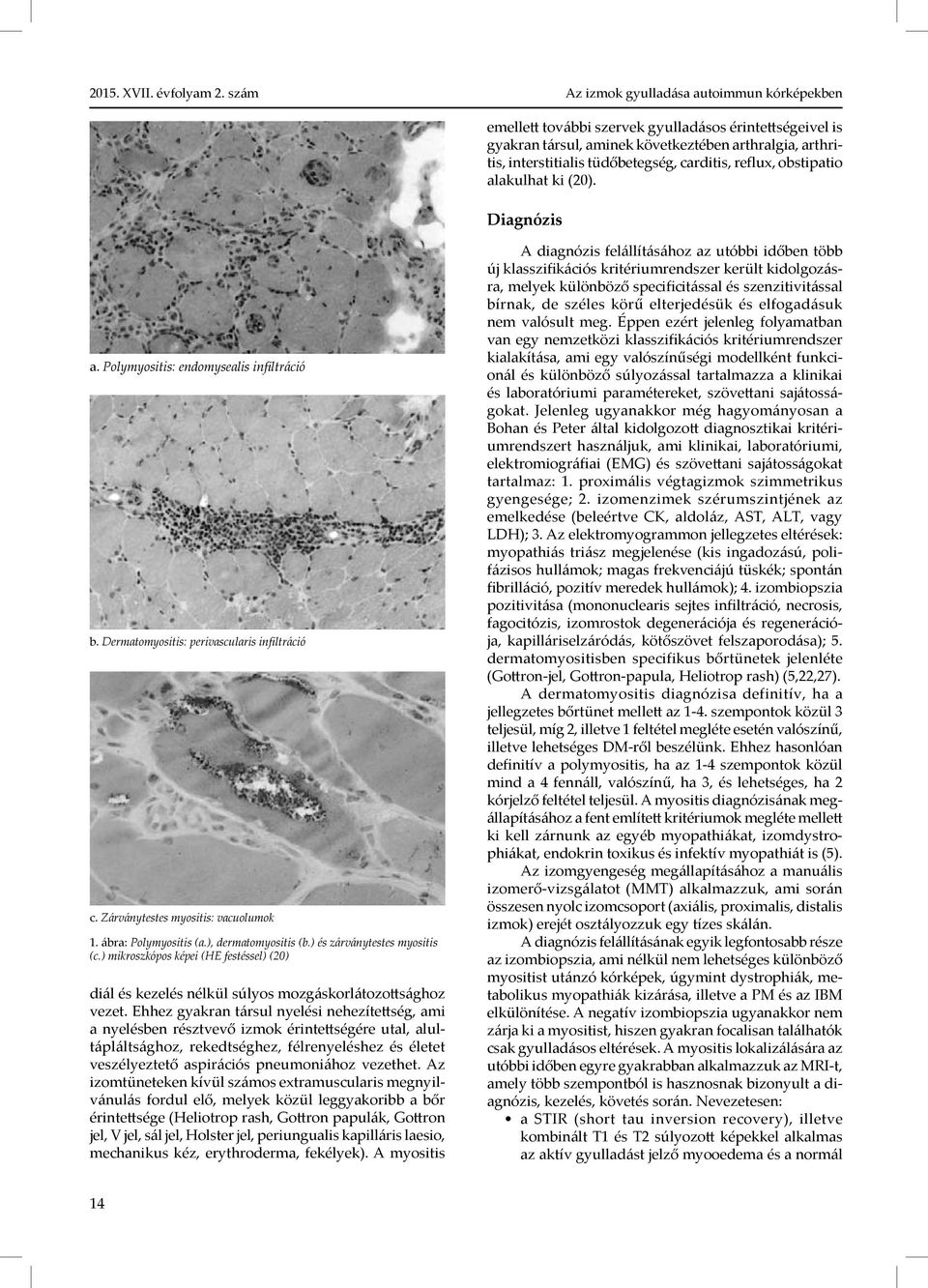 ), dermatomyositis (b.) és zárványtestes myositis (c.) mikroszkópos képei (HE festéssel) (20) diál és kezelés nélkül súlyos mozgáskorlátozottsághoz vezet.