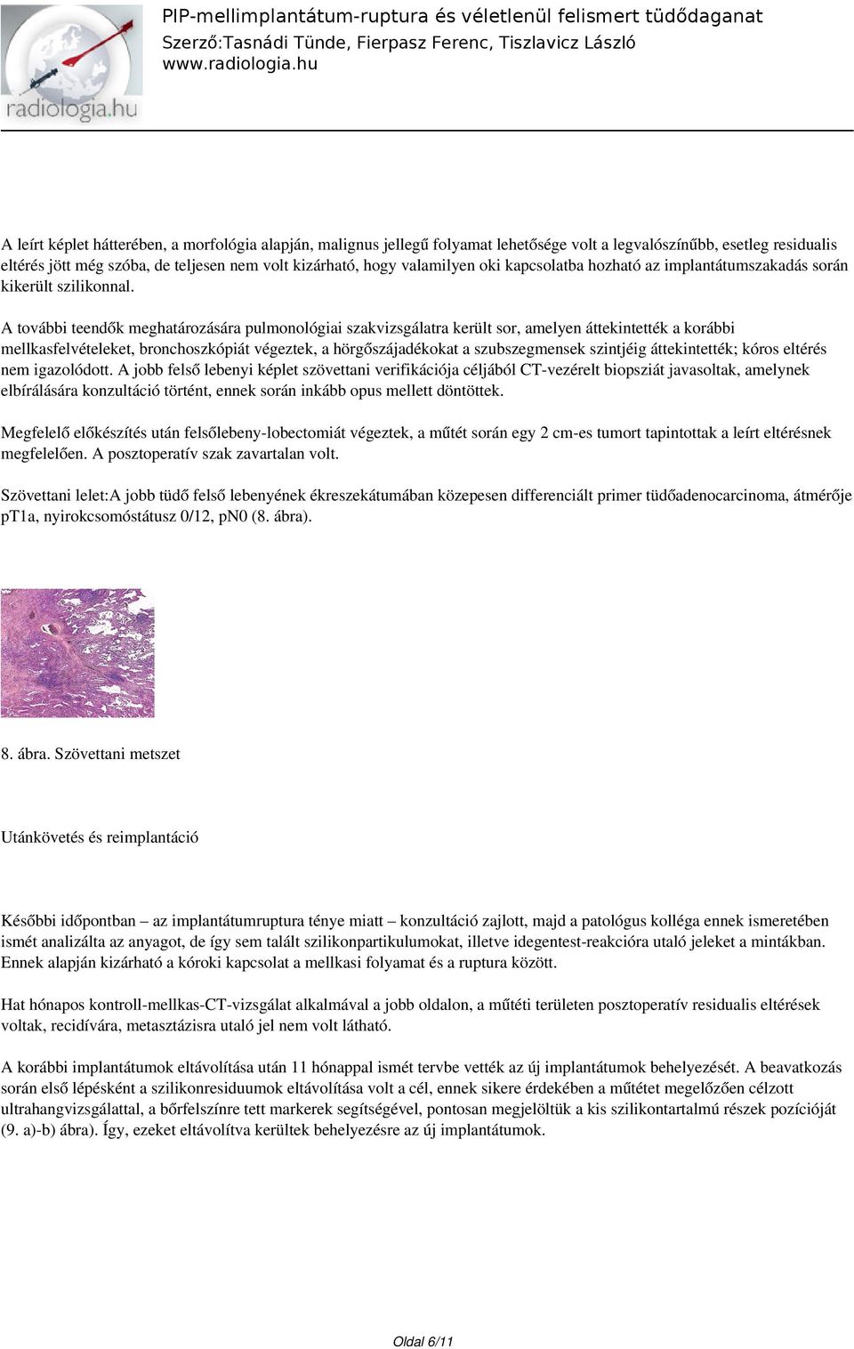 A további teendők meghatározására pulmonológiai szakvizsgálatra került sor, amelyen áttekintették a korábbi mellkasfelvételeket, bronchoszkópiát végeztek, a hörgőszájadékokat a szubszegmensek