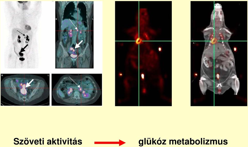 glükóz