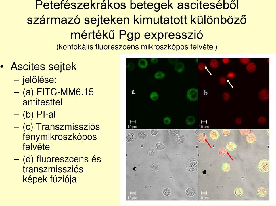 Ascites sejtek jelölése: (a) FITC-MM6.