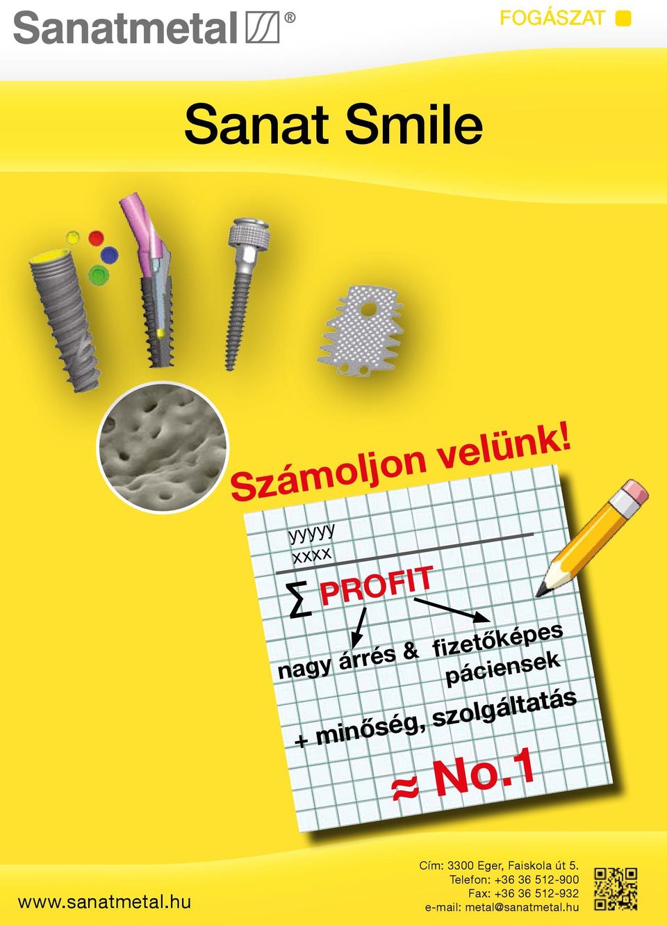 minőség, szolgáltatás No.1 www.sanatmetal.