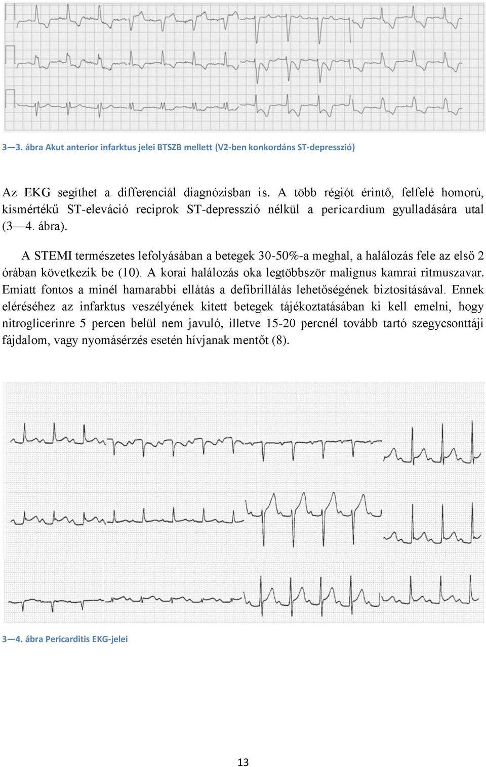 A STEMI természetes lefolyásában a betegek 30-50%-a meghal, a halálozás fele az első 2 órában következik be (10). A korai halálozás oka legtöbbször malignus kamrai ritmuszavar.