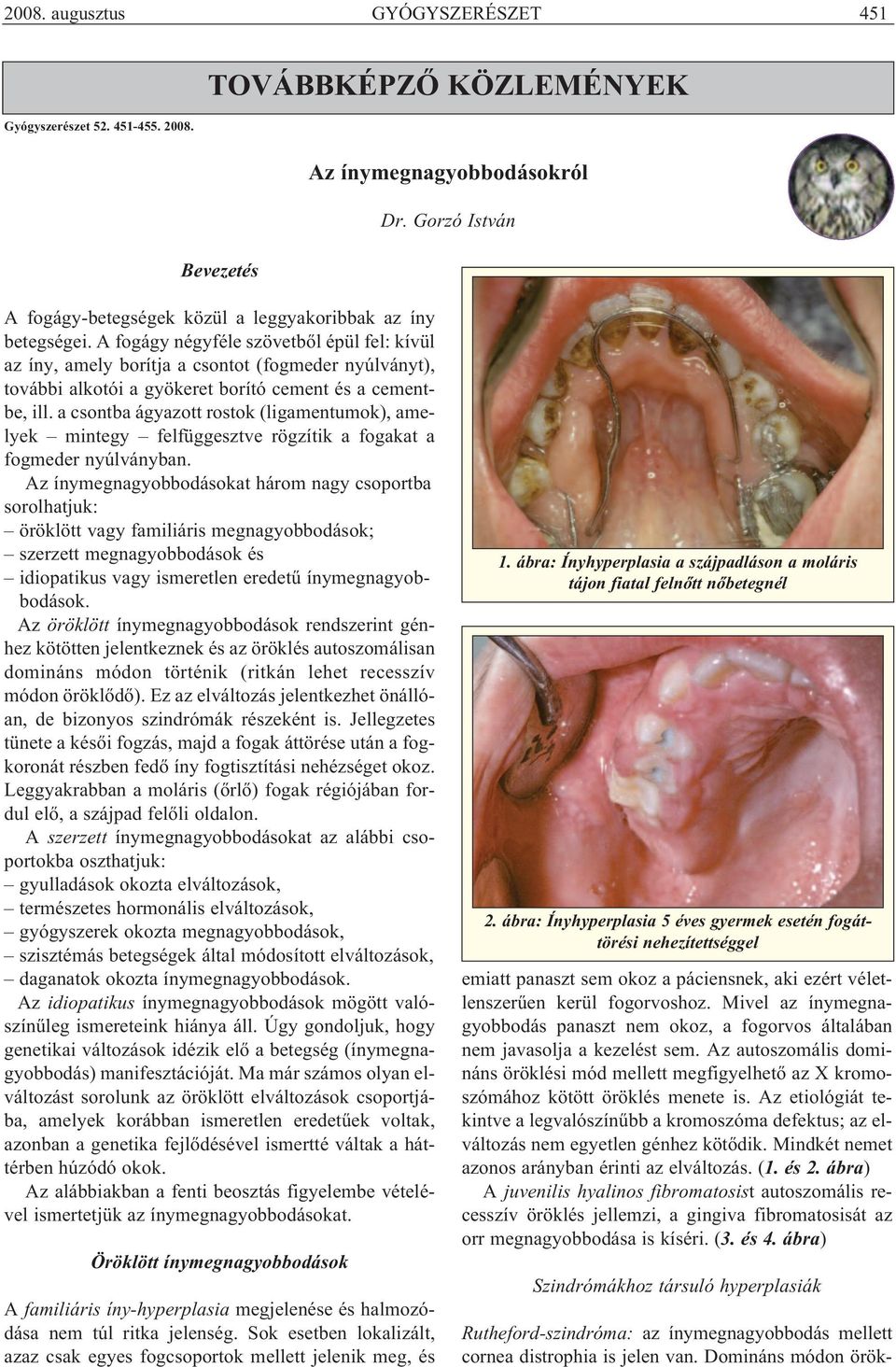 A fogágy négyféle szövetből épül fel: kívül az íny, amely borítja a csontot (fogmeder nyúlványt), további alkotói a gyökeret borító cement és a cementbe, ill.