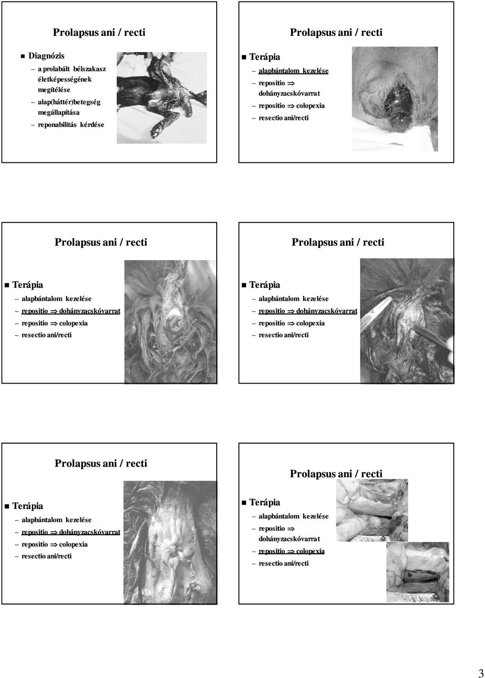 repositio dohányzacskóvarrat resectio ani/recti repositio dohányzacskóvarrat resectio
