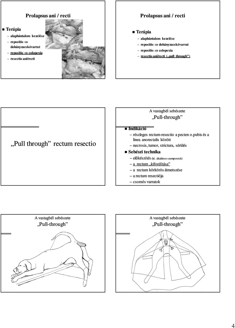 pubis és a linea anorectalis között necrosis, tumor, strictura, sérülés Sebészi technika előkészítés