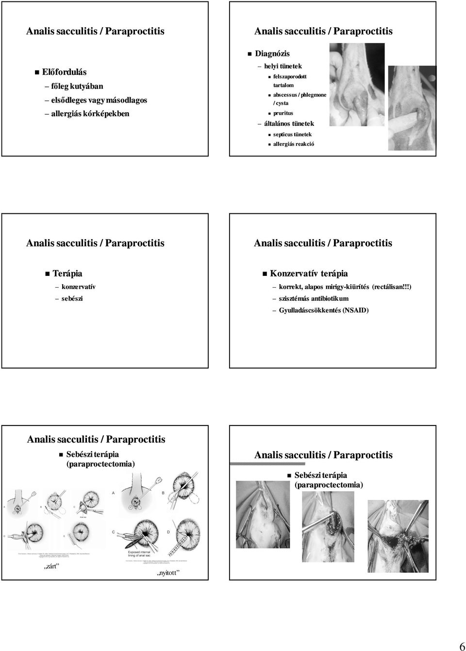 Analis sacculitis / Paraproctitis konzervatív sebészi Konzervatív terápia korrekt, alapos mirigy-kiürítés (rectálisan!