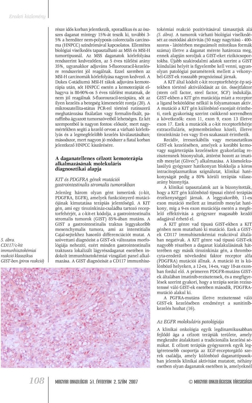nem-polyposis colorectalis carcinoma (HNPCC) szindrómával kapcsolatos. Ellentétes biológiai viselkedés tapasztalható az MSS és MSI-H tumortípusnál.