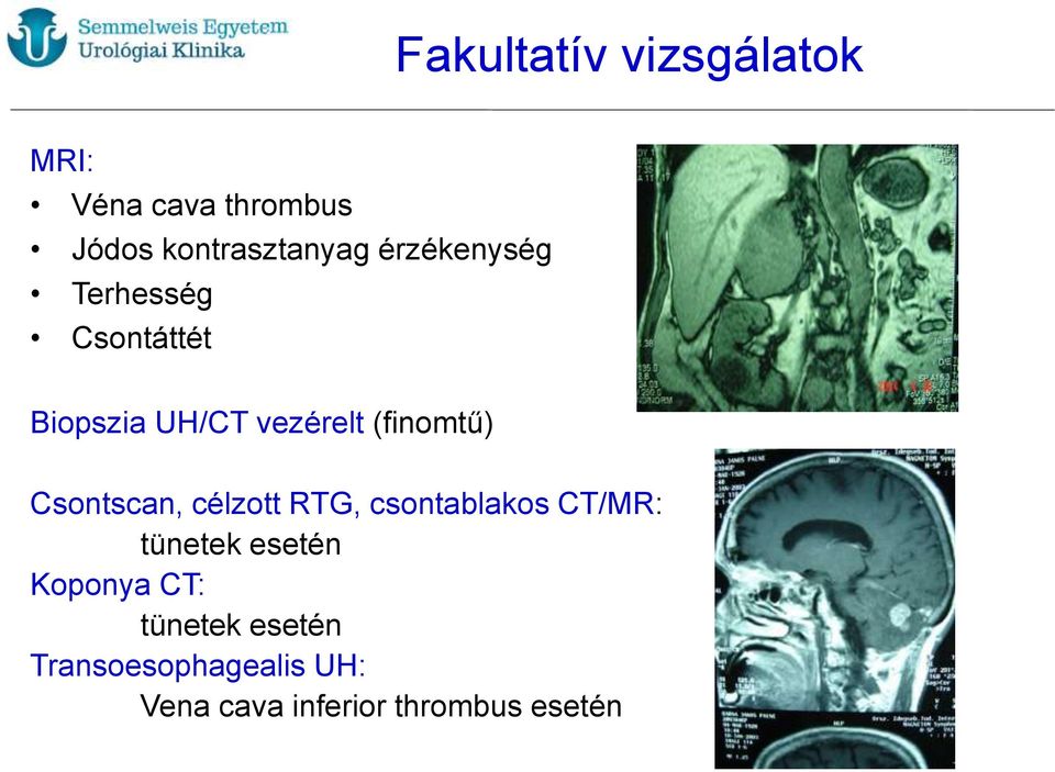 Csontscan, célzott RTG, csontablakos CT/MR: tünetek esetén Koponya