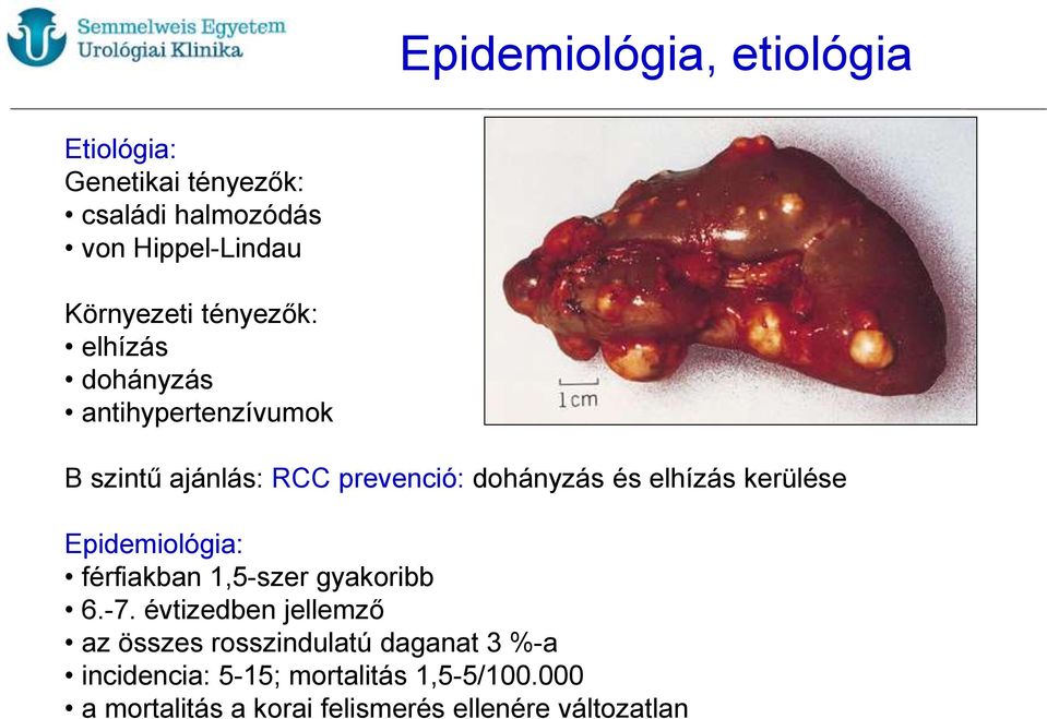 kerülése Epidemiológia: férfiakban 1,5-szer gyakoribb 6.-7.