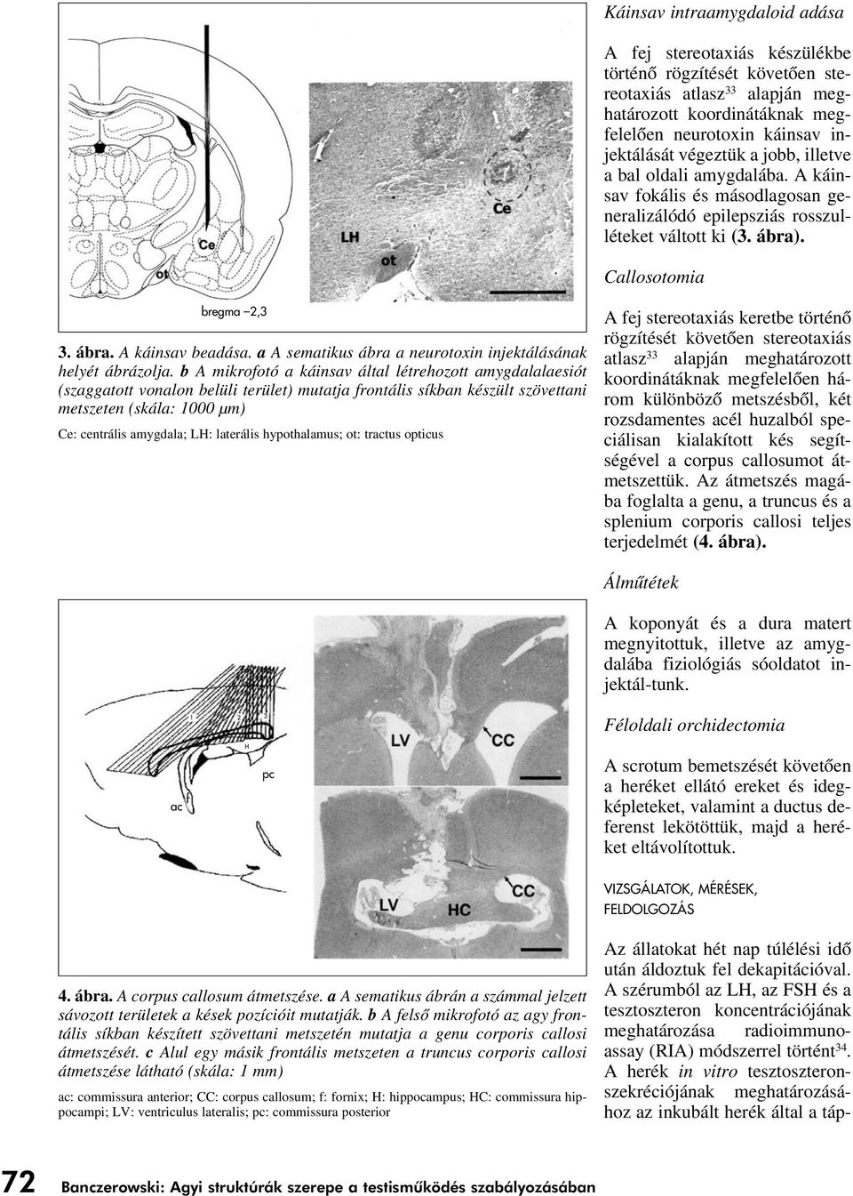 a A sematikus ábra a neurotoxin injektálásának helyét ábrázolja.