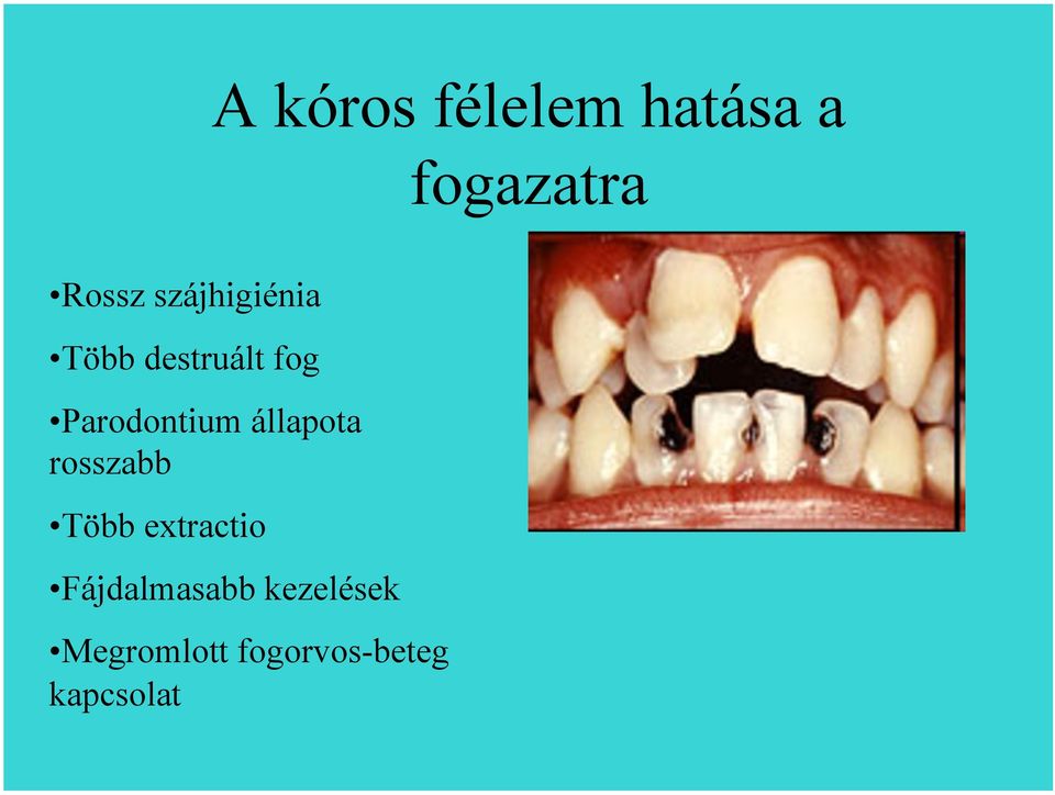 állapota rosszabb Több extractio