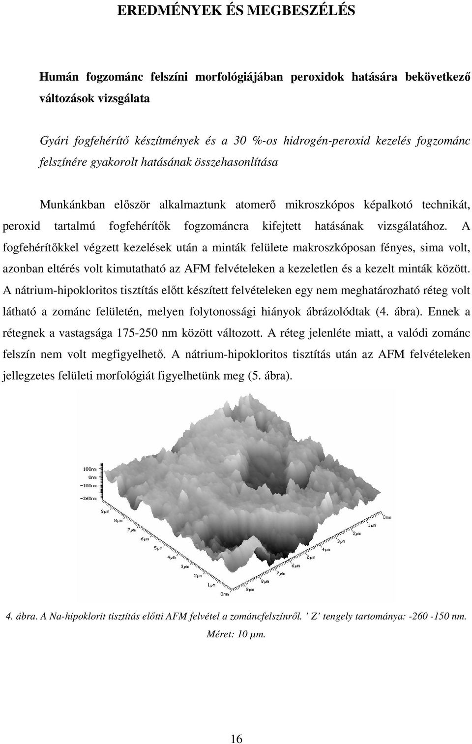 A fogfehérítıkkel végzett kezelések után a minták felülete makroszkóposan fényes, sima volt, azonban eltérés volt kimutatható az AFM felvételeken a kezeletlen és a kezelt minták között.