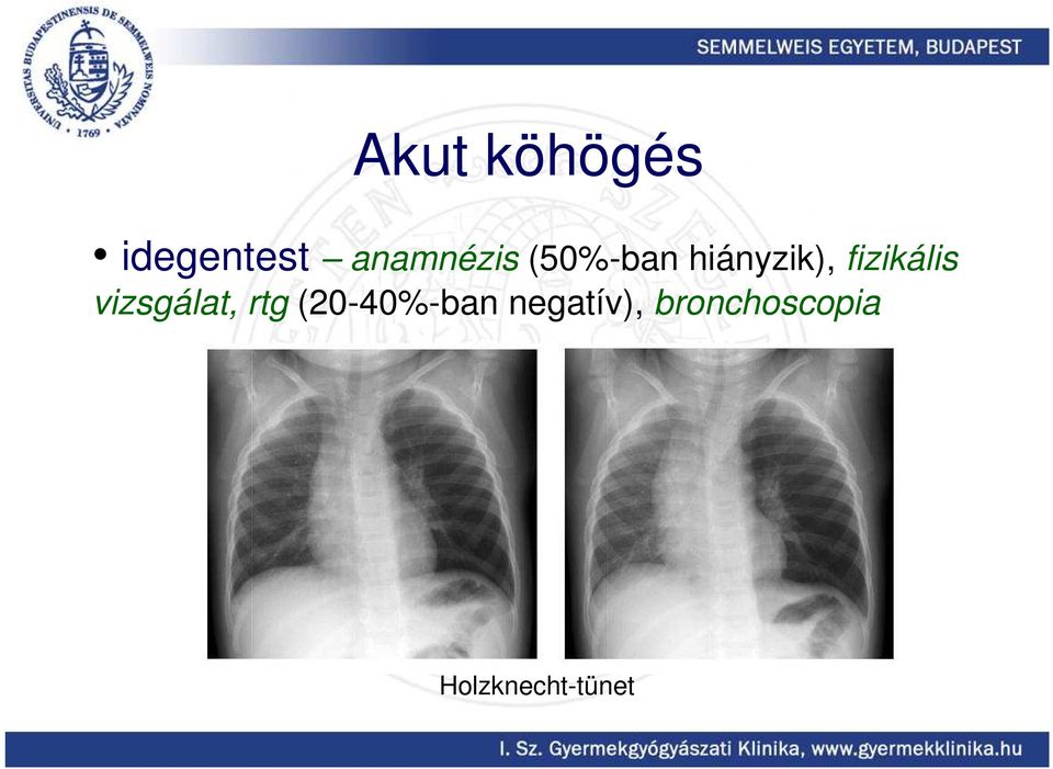 fizikális vizsgálat, rtg